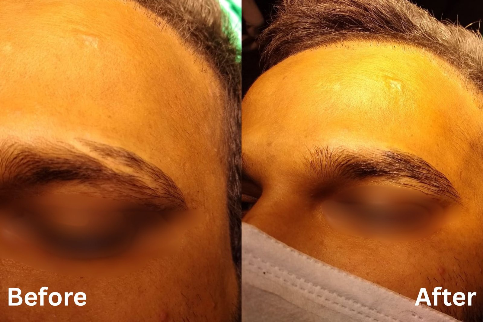 Eyebrow correction