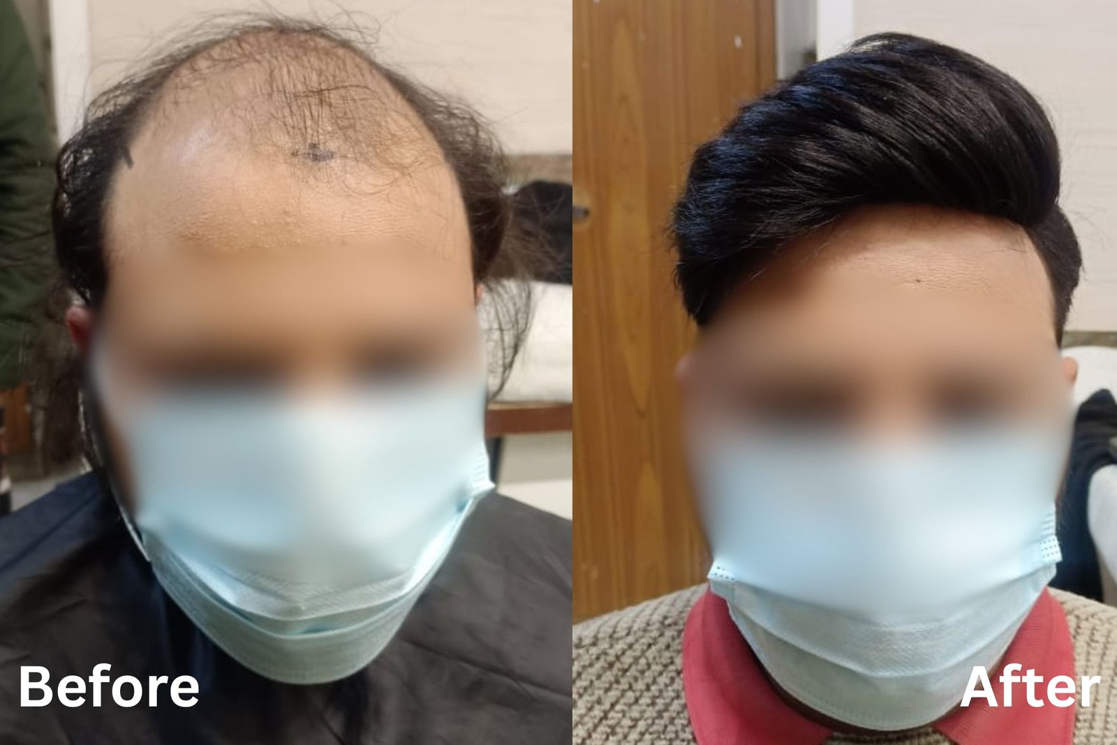 Hair system styling